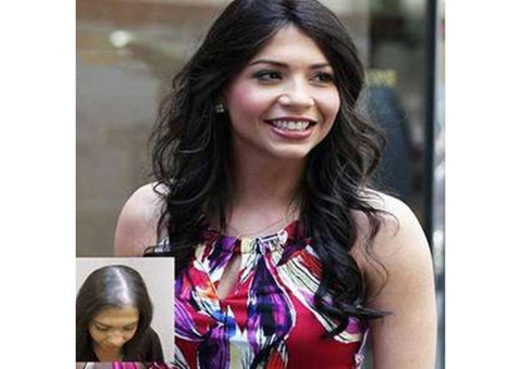 Hair System for Women in Yorba Linda