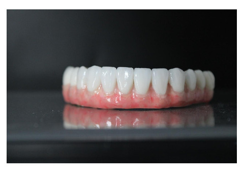 Dental implants Tijuana