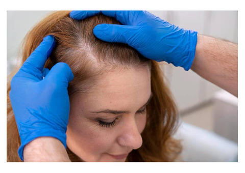 Best Hair Extensions For Thin Hair