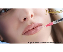 Enhance Your Smile with Lip Fillers Riverside at Skintastic