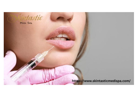Enhance Your Look with Lip Fillers Riverside at Skintastic