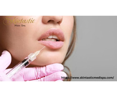 Enhance Your Look with Lip Fillers Riverside at Skintastic