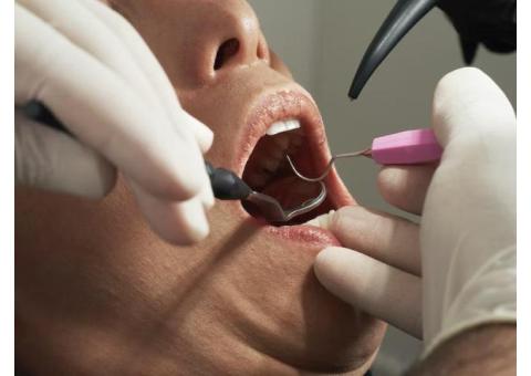Scaling and Polishing Teeth in Noida