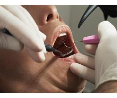 Scaling and Polishing Teeth in Noida