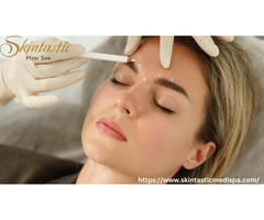 Transform Your Look with Fillers Riverside at Skintastic