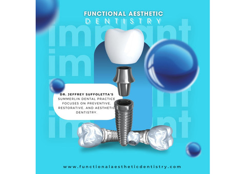 Dental implants Summerlin