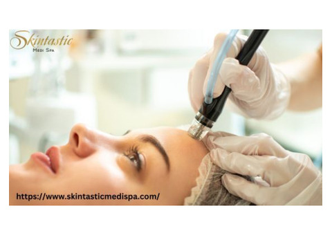 Achieve Radiant Skin with Hydrafacial in Riverside at Skintastic