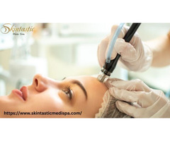 Achieve Radiant Skin with Hydrafacial in Riverside at Skintastic