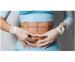 Trusted Tummy Tuck Surgeon in Raleigh, NC