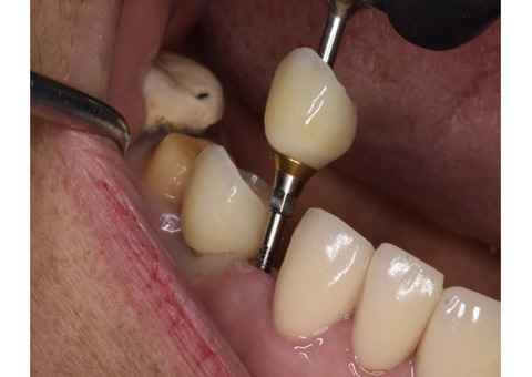 Dental clinic Tijuana