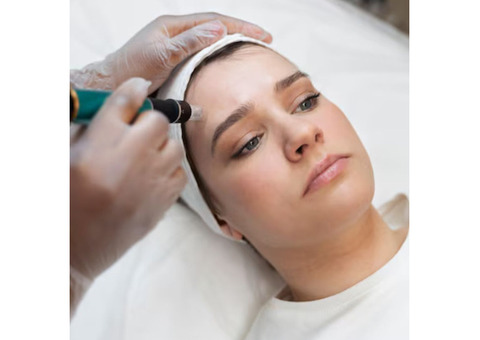 HydraFacial Treatment for Acne