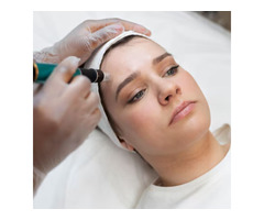 HydraFacial Treatment for Acne