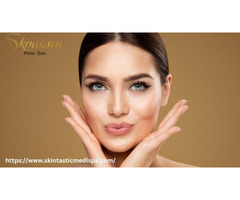 Enhance Your Beauty with Lip Fillers Riverside at Skintastic