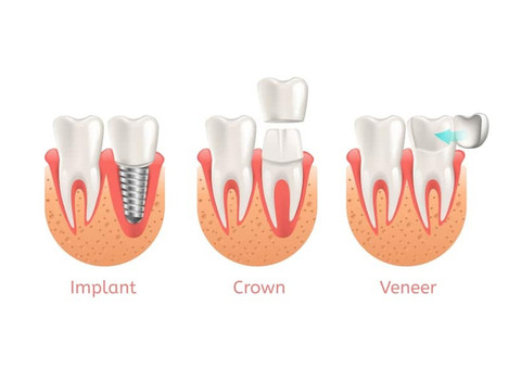 Summerlin dentist