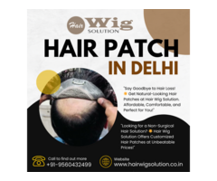 Affordable Hair Patch in Delhi – Hair Wig Solution