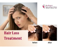 Top Hair Loss Treatment in Bangalore: Regain Your Confidence!