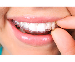 Clear Aligners for Complex Orthodontic Cases