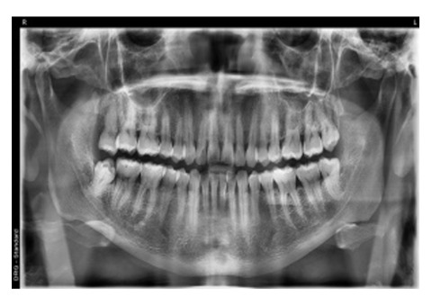 Biological Dentist in Tijuana, Mexico – Safe, Natural Dental Care