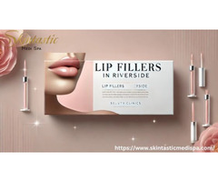 Enhance Your Look with Lip Fillers in Riverside