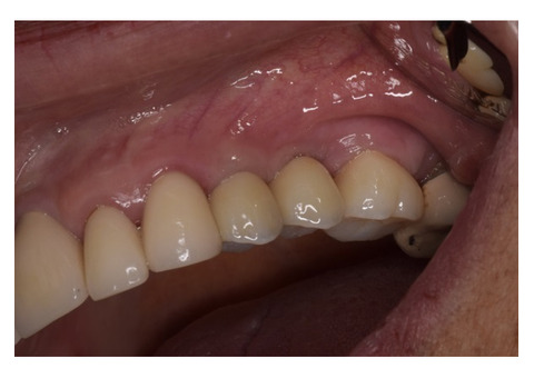 Biological Dentist in Tijuana, Mexico – Safe, Natural Dental Care