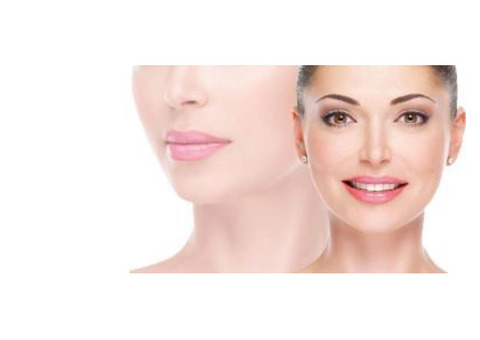 Laser Therapy for Pigmentation in Bangalore - RMV - Kosmoderma