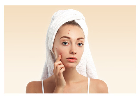 Say Goodbye to Dark Spots with Hyperpigmentation Serum for Face