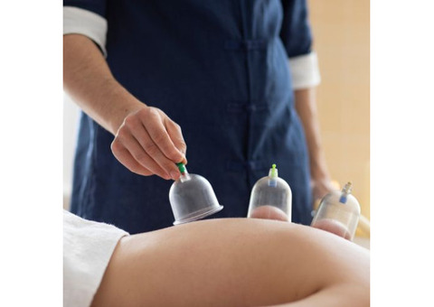 Myofascial Cupping Massage