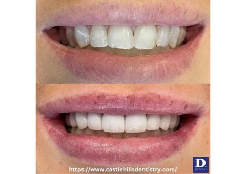 Deep Cleaning Lewisville TX