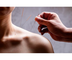 Trusted Portland in Maine Acupuncture for Pain & Wellness
