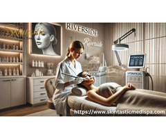 Discover Relaxing Facial in Riverside CA Treatments Experience