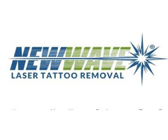 New Wave Laser Tattoo Removal | Face Tattoo Removal Bethlehem