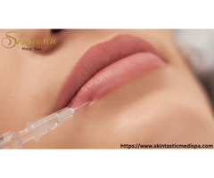 Achieve Natural Lips with Personalized Lip Filler Riverside Treatments