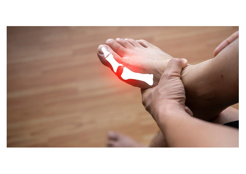 Uric Acid Treatment in Homeopathy | Sahil Homoeo Care