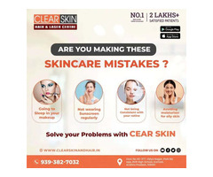 Laser Treatment For Birthmark Removal In India