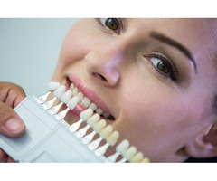 Teeth Bleaching in Toronto: Reveal a Whiter, Brighter Smile