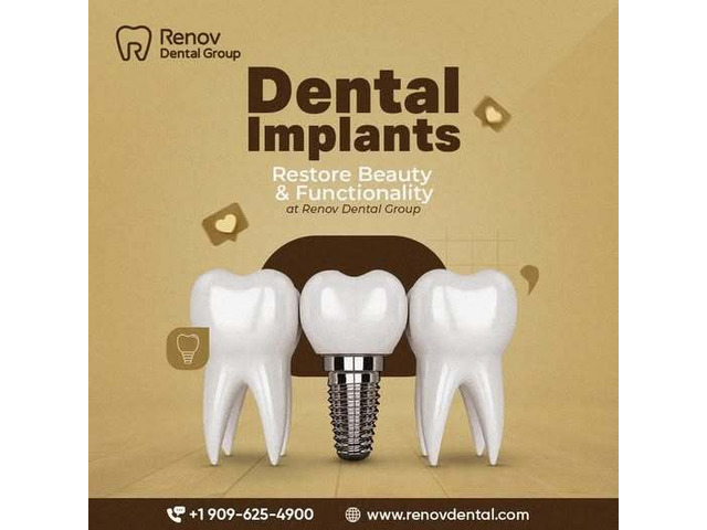 Implant Supported Dentures Claremont