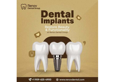 Implant Supported Dentures Claremont