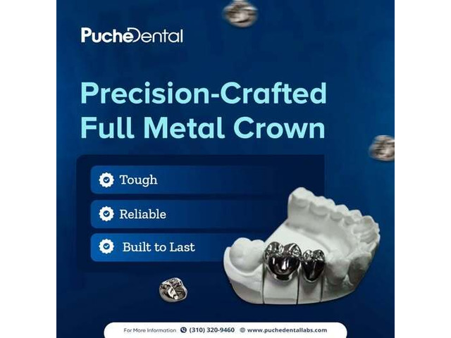 ceramic crown preparation