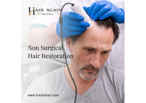 Non Surgical Hair Replacement For Men in Fresno