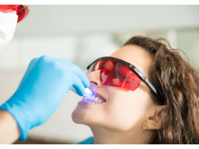 Ottawa’s Top-Recommended Teeth Whitening Solutions