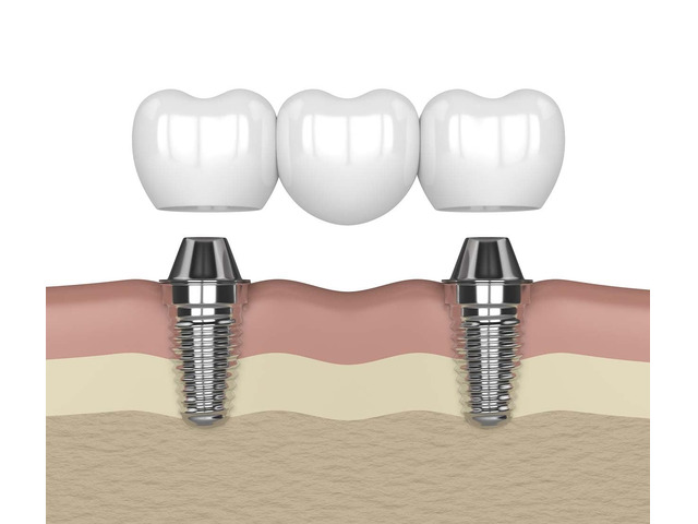 Your Trusted Dentist on Laurel St in Rancho Cucamonga