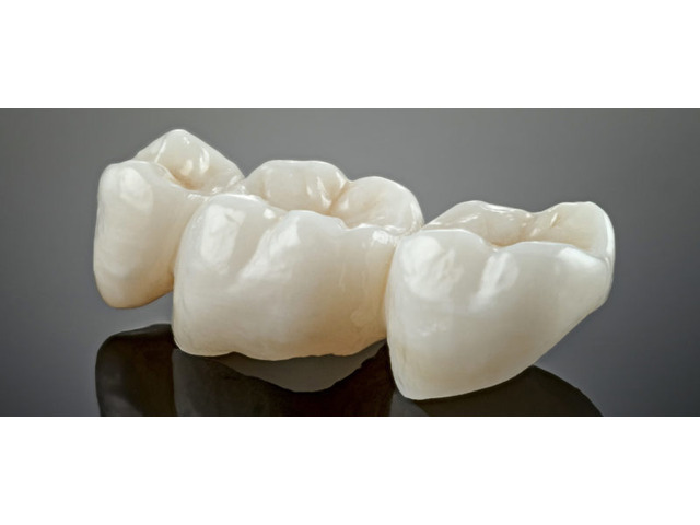 Family Dentist In Ontario, CA