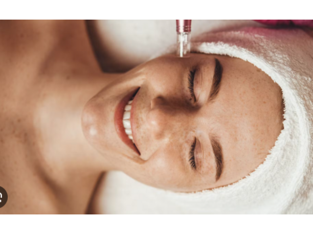 Microneedling Portland Oregon