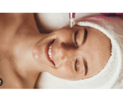 Microneedling Portland Oregon