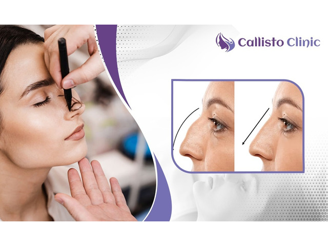 Best Rhinoplasty Experts in Surat – Callisto Clinic
