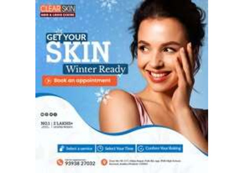 portwine stain treatment in india
