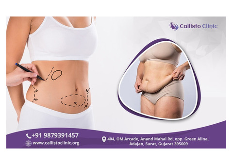 Liposuction in Surat – Callisto Clinic