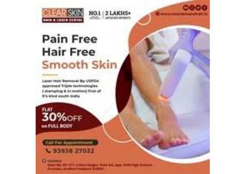 Best Advanced Laser Treatment for Birthmark Removal