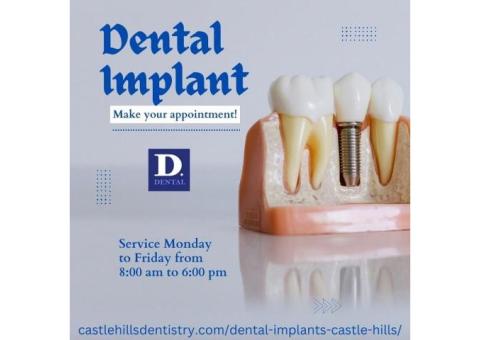 Dental Implant Specialist in Lewisville