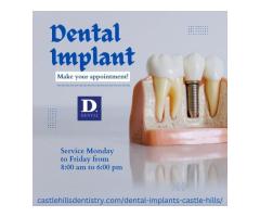 Dental Implant Specialist in Lewisville